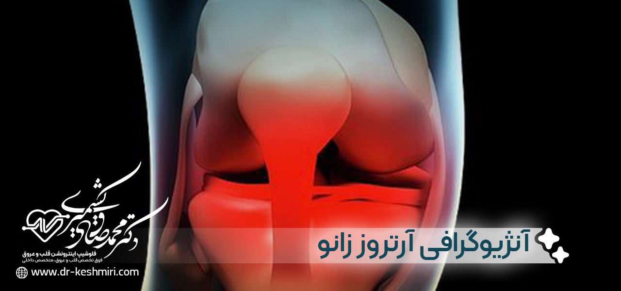 مقایسه ی آنژیوگرافی با کاتتر و سی تی آنژیوگرافی