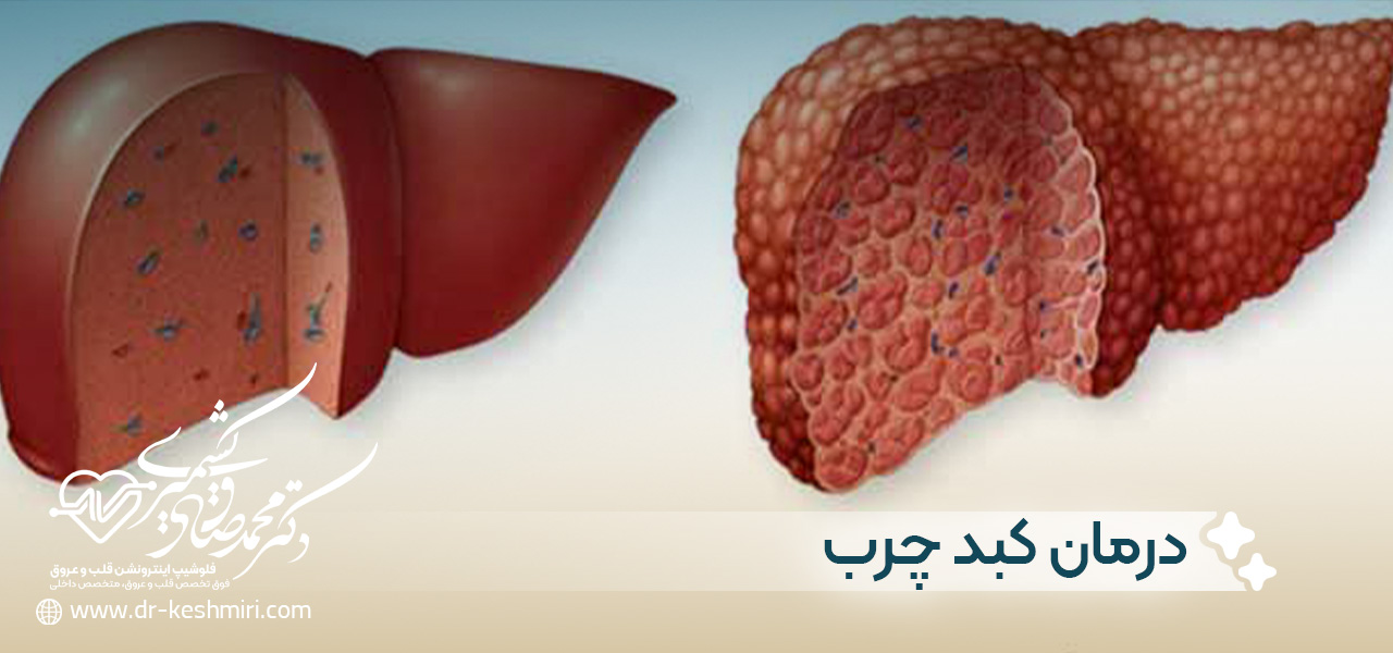 درمان کبد چرب