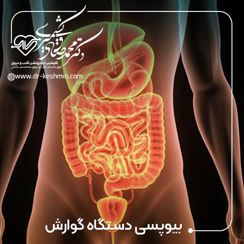 بیوپسی دستگاه گوارش