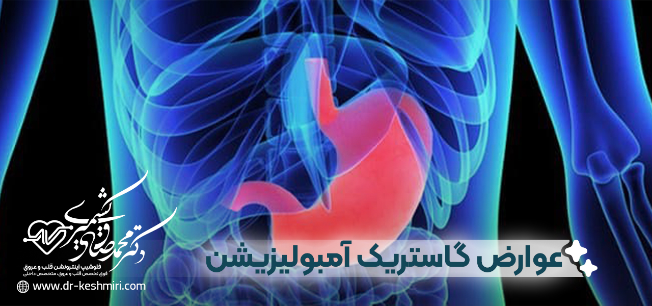 عوارض انجام گاستریک آمبولیزیشن