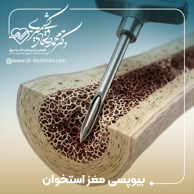 بیوپسی مغز استخوان چیست؟