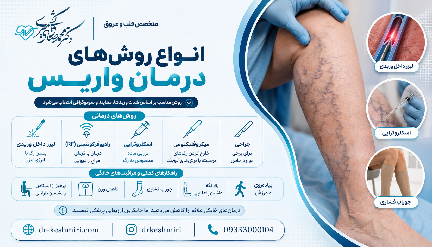 انواع روش های درمان واریس