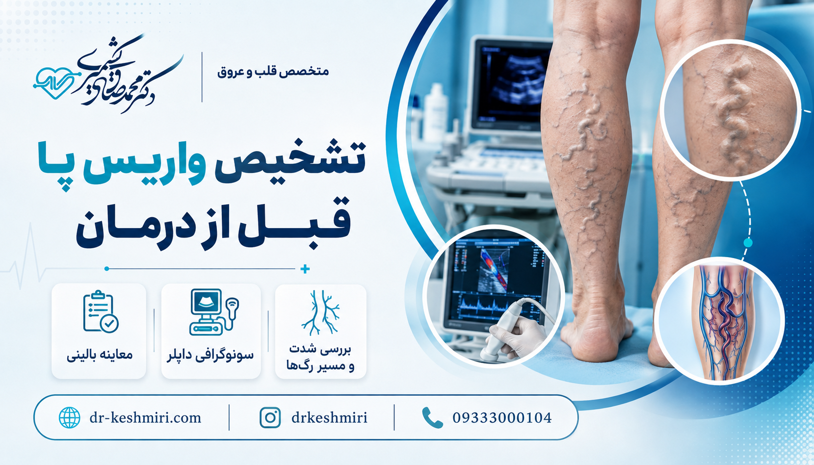تشخیص واریس پا قبل از درمان