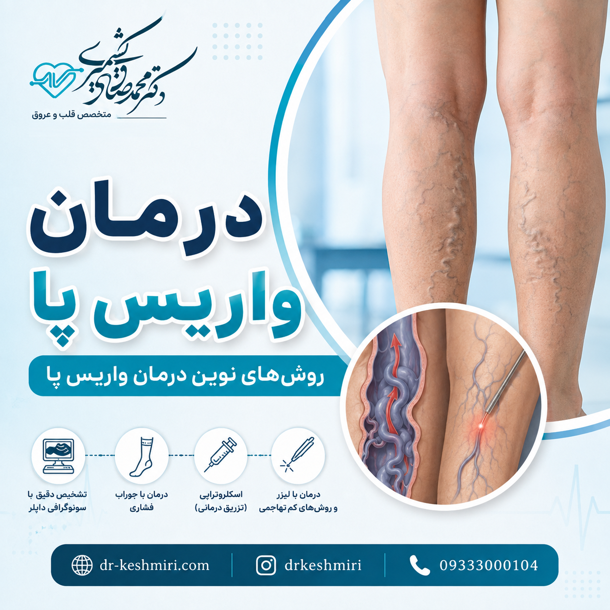 درمان واریس پا