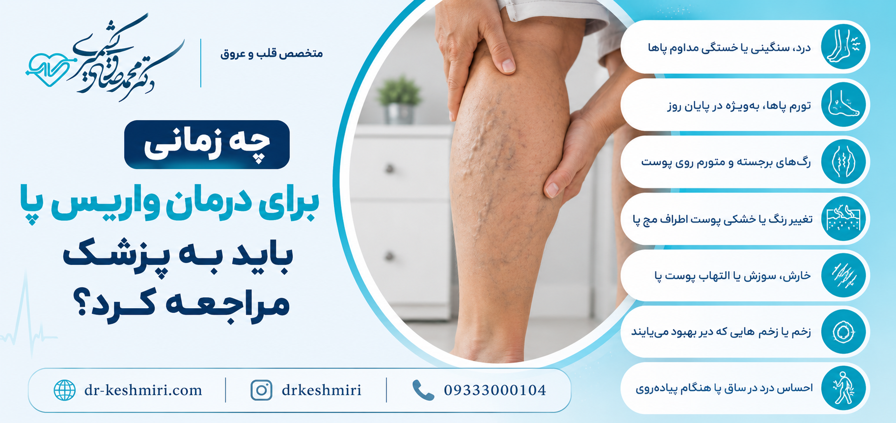 چه زمانی برای درمان واریس پا باید به پزشک مراجعه کرد؟