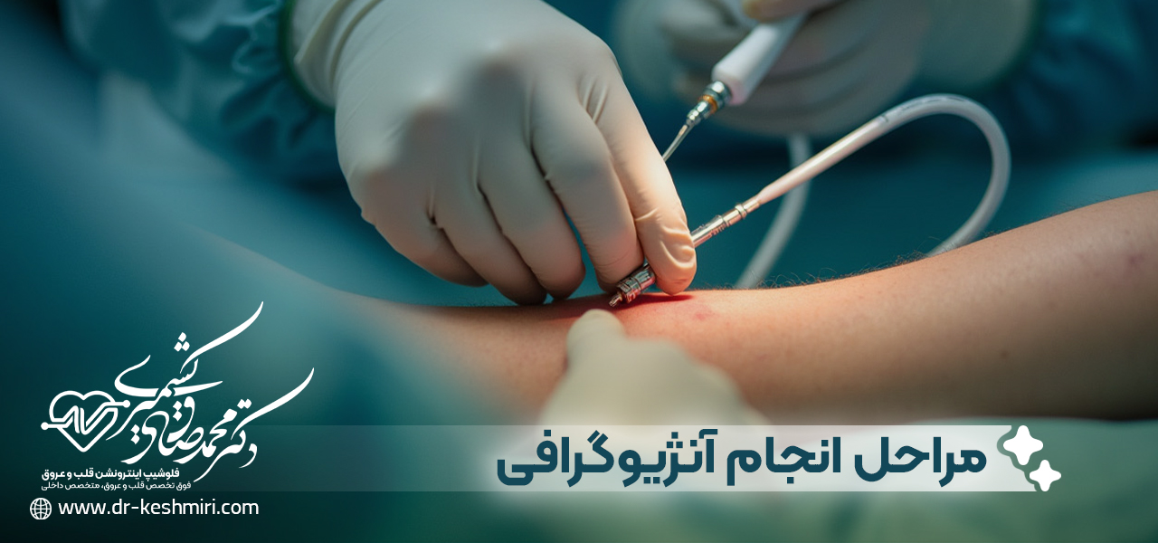 مراحل انجام آنژیوگرافی پروستات