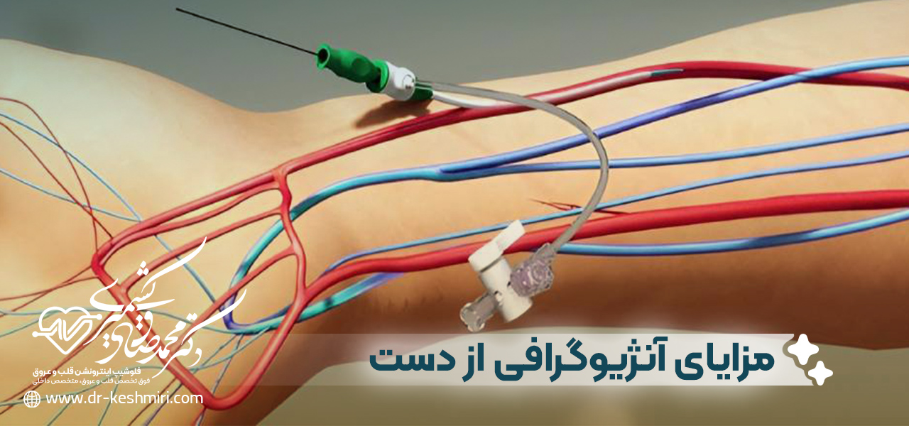 مزایای آنژیوگرافی از دست