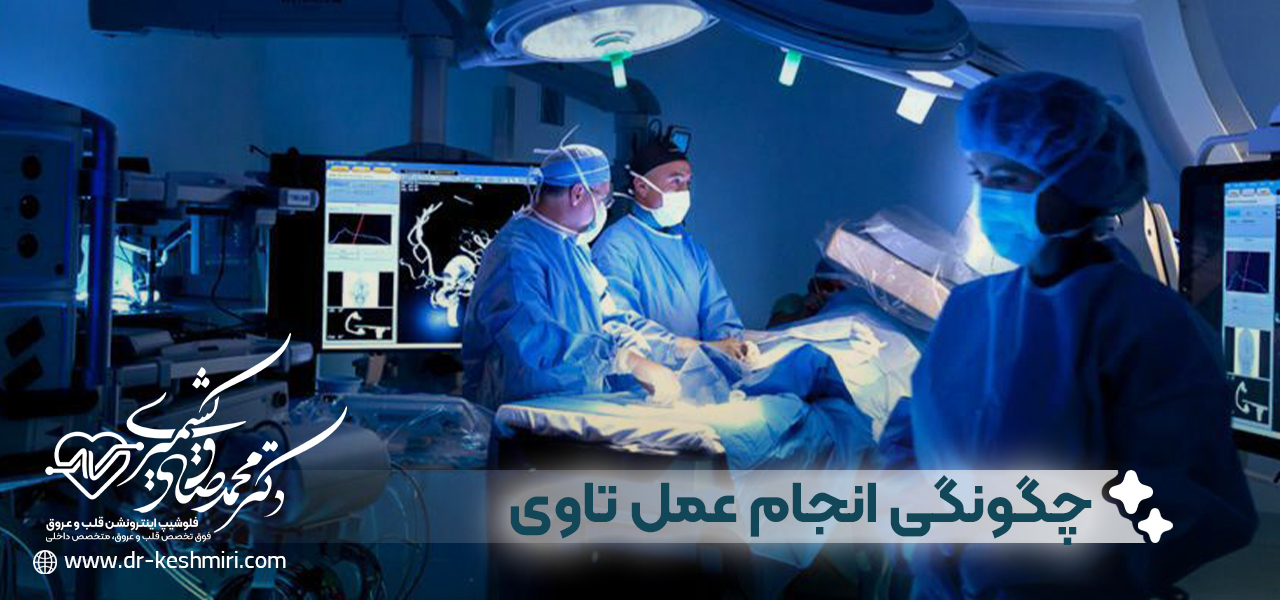 چگونگی انجام عمل تاوی TAVI