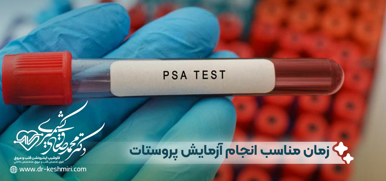 زمان مناسب انجام آزمایش پروستات