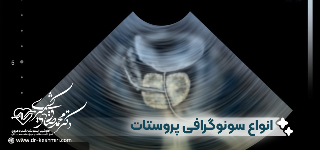 انواع سونوگرافی پروستات