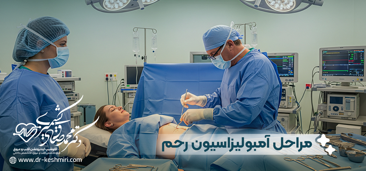 مراحل انجام آمبولیزاسیون رحم