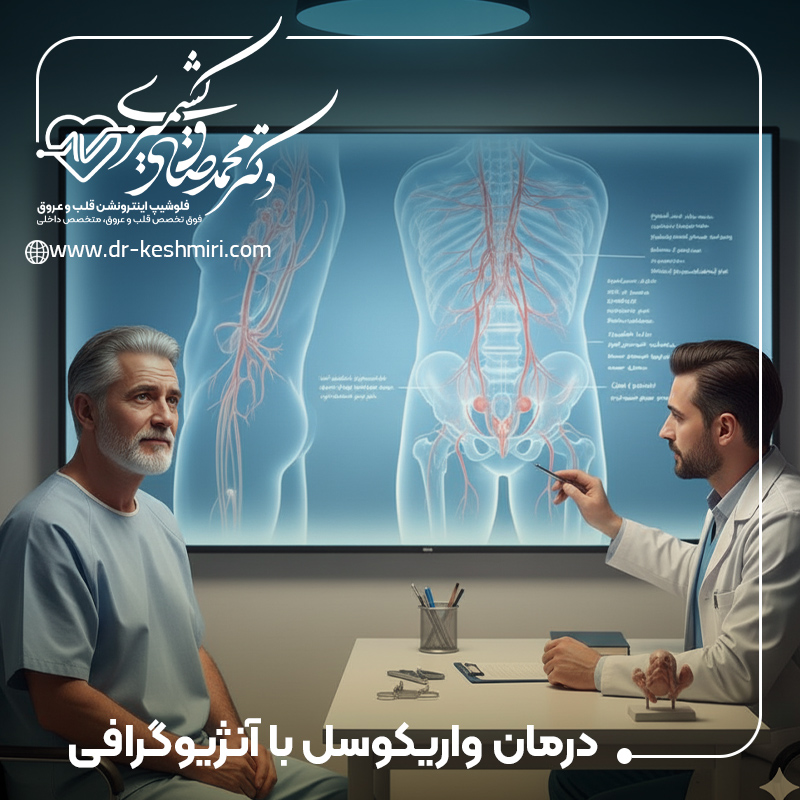 درمان واریکوسل با آنژیوگرافی