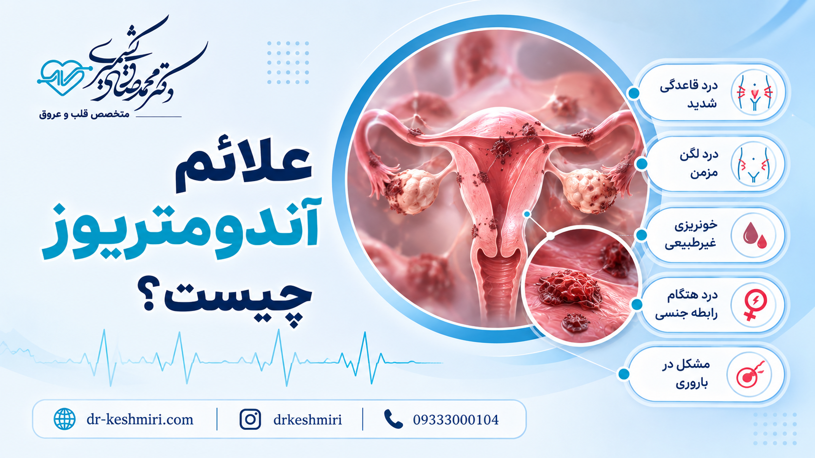علائم آندومتریوز چیست؟