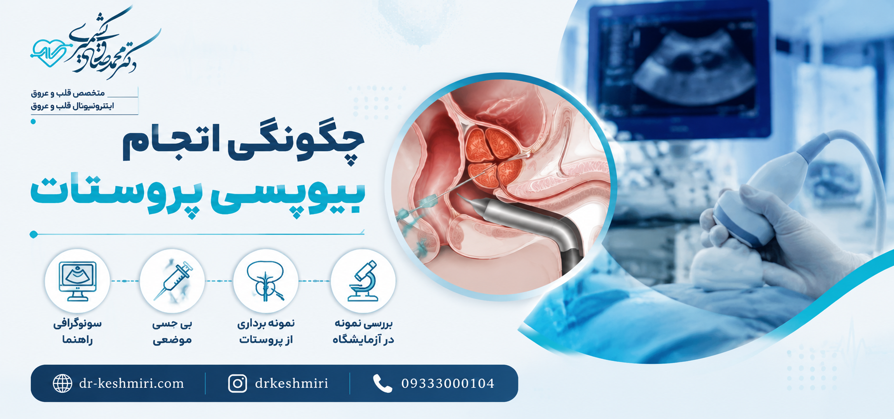 چگونگی انجام بیوپسی پروستات